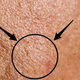 Image for article titled Can Donald Trump Grow A Beard? An Investigation